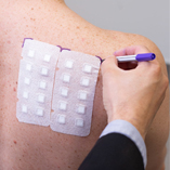 How to Patch Test: A Physician’s Guide to Clinical Protocols and Diagnostic Accuracy