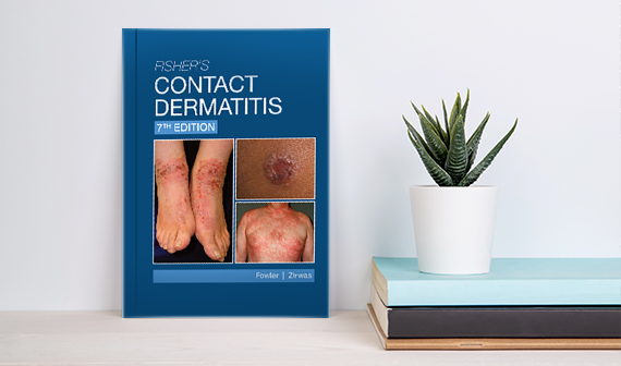 Fishers Contact Dermatitis -7th Edition